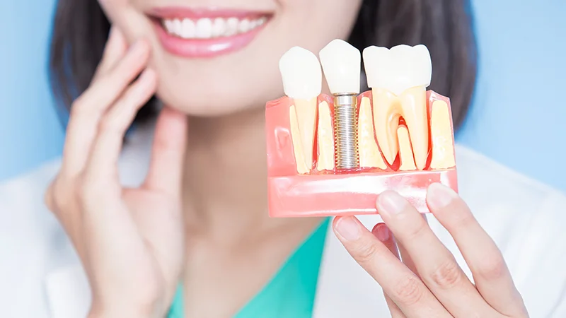 Woman holding implant abutment options model